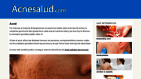 What Acnesalud.com website looked like in 2020 (4 years ago)