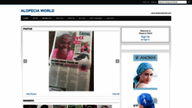 What Alopeciaworld.com website looked like in 2020 (3 years ago)