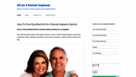 What All-on-4-dentalimplants.com website looked like in 2021 (2 years ago)