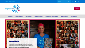 What Alopecia.org.uk website looked like in 2021 (2 years ago)