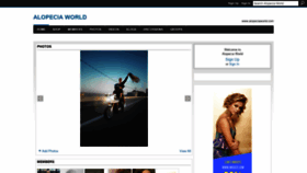 What Alopeciaworld.com website looked like in 2021 (2 years ago)