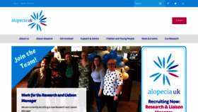 What Alopecia.org.uk website looked like in 2022 (1 year ago)