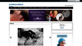 What Alopeciaworld.com website looked like in 2022 (1 year ago)