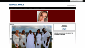 What Alopeciaworld.com website looked like in 2023 (This year)