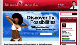 What Breastimplants4you.com website looked like in 2017 (6 years ago)