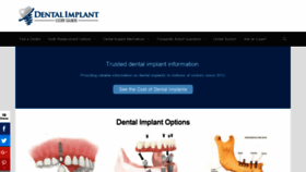 What Dentalimplantcostguide.com website looked like in 2019 (5 years ago)