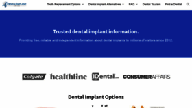 What Dentalimplantcostguide.com website looked like in 2021 (3 years ago)