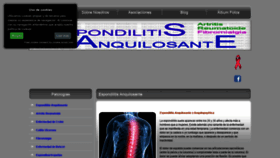 What Espondilitis.eu website looked like in 2019 (4 years ago)