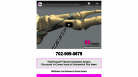 What Fastforwardbunion.com website looked like in 2019 (4 years ago)