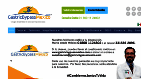 What Gastricbypassmexico.com website looked like in 2017 (7 years ago)