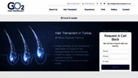 What Go2hairtransplant.co.uk website looked like in 2021 (3 years ago)