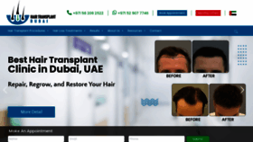 What Hairtransplantdubai.com website looked like in 2022 (1 year ago)