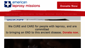 What Leprosy.org website looked like in 2017 (6 years ago)