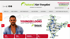 What Naturalhairtransplant.co.in website looked like in 2016 (8 years ago)