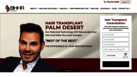 What Palmdeserthairtransplant.com website looks like in 2024 