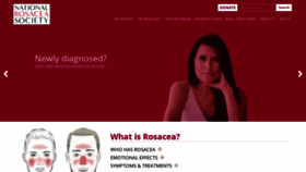 What Rosacea.org website looked like in 2019 (4 years ago)