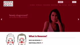 What Rosacea.org website looked like in 2023 (This year)