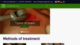What Scarshelper.com website looked like in 2018 (6 years ago)