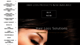 What Totalhairlosssolutions.com website looked like in 2018 (5 years ago)